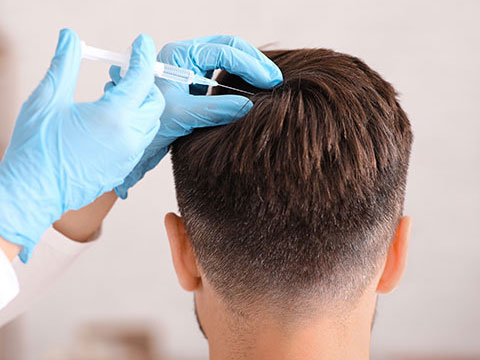 prp- hairloss
